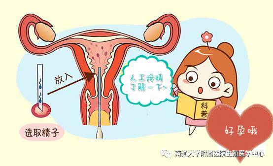 卵子捐赠