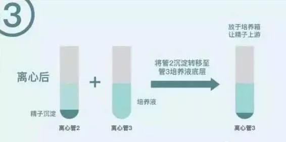 捐卵