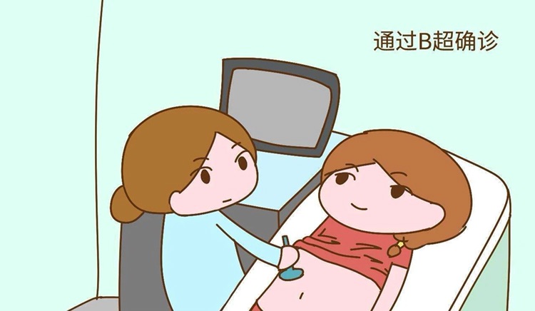 无锡捐卵费用