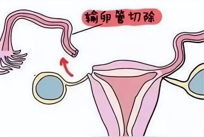 高薪捐卵招聘