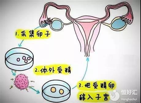 邢台捐卵机构